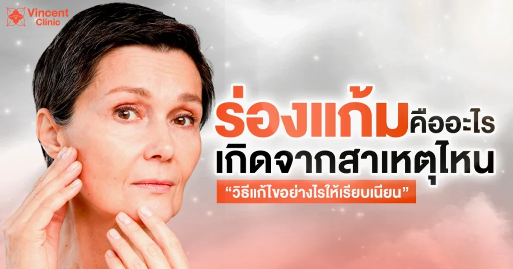 ร่องแก้มคืออะไร