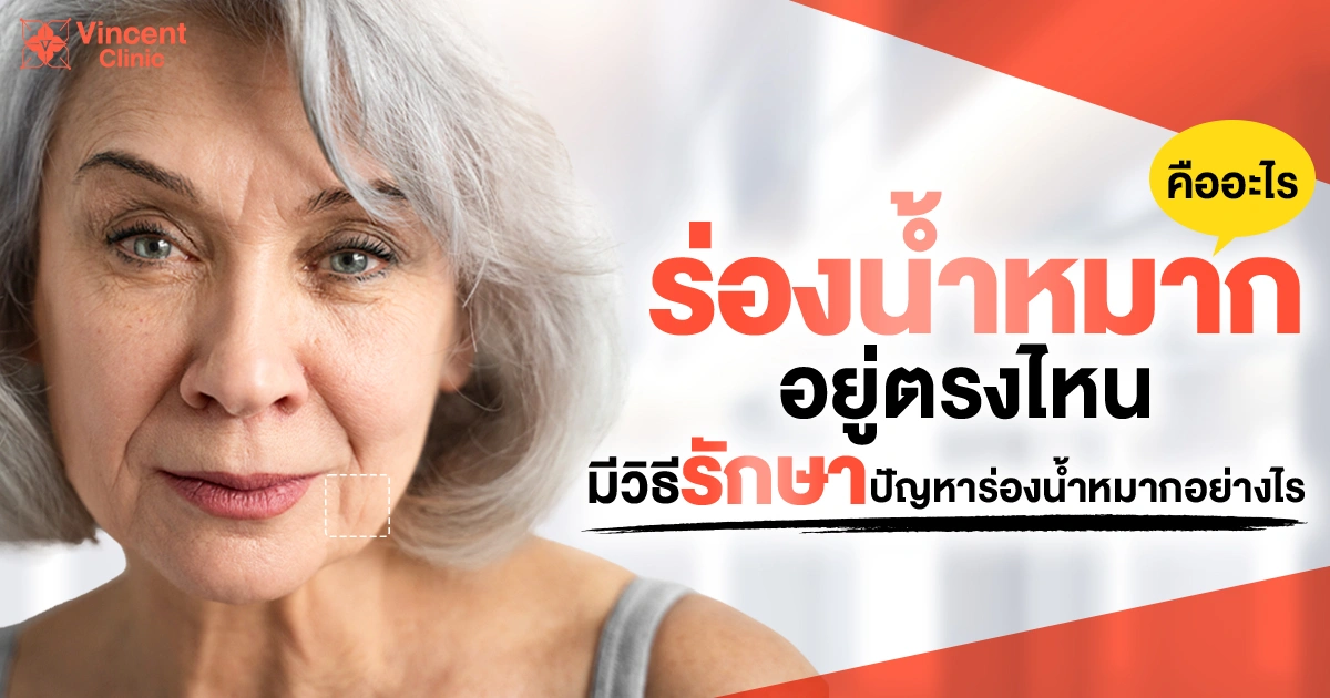 ร่องน้ำหมากอยู่ตรงไหน