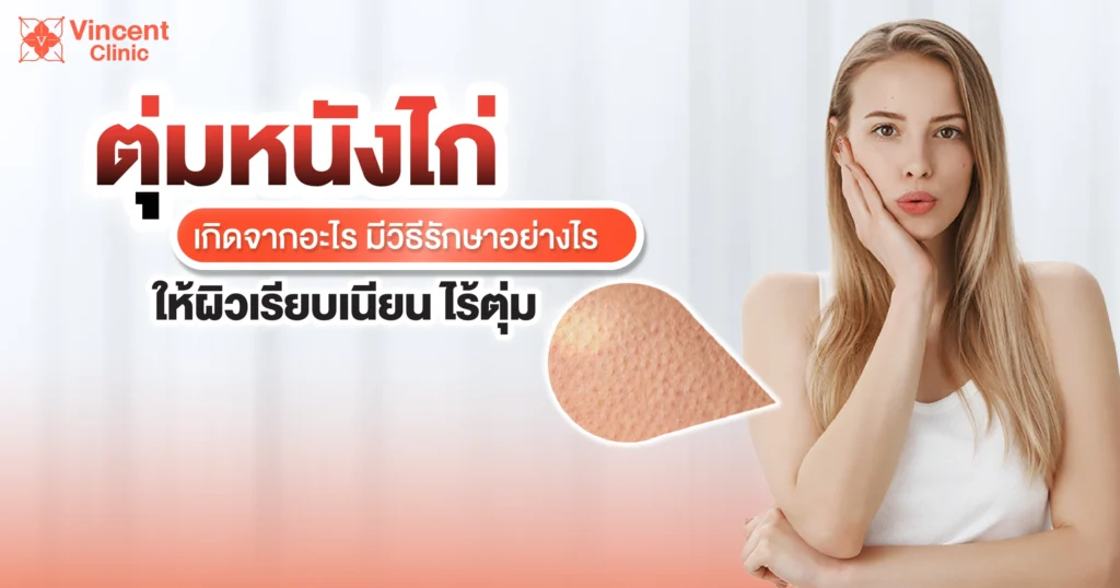 ตุ่มหนังไก่ เกิดจากอะไร