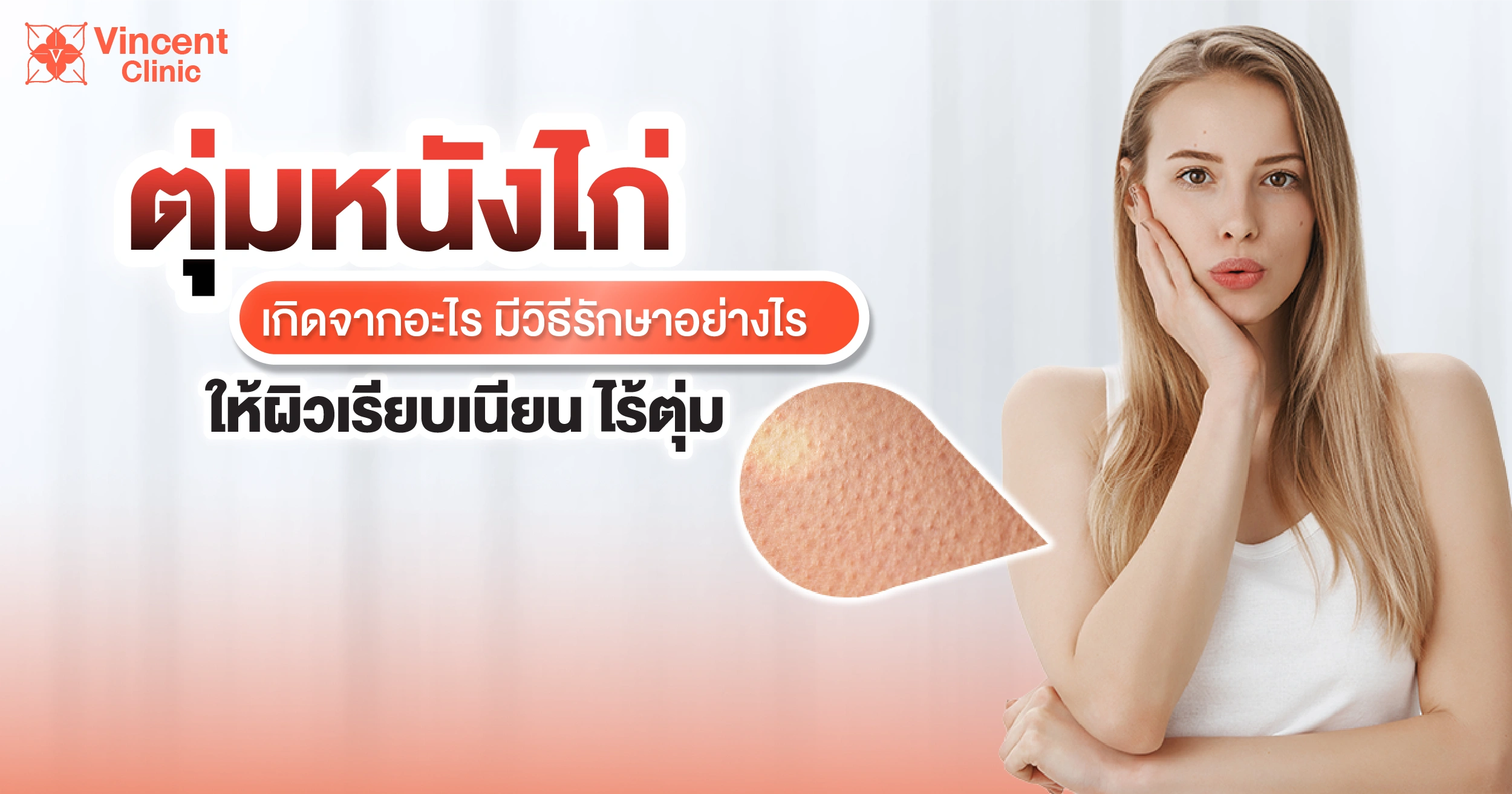 ตุ่มหนังไก่ เกิดจากอะไร