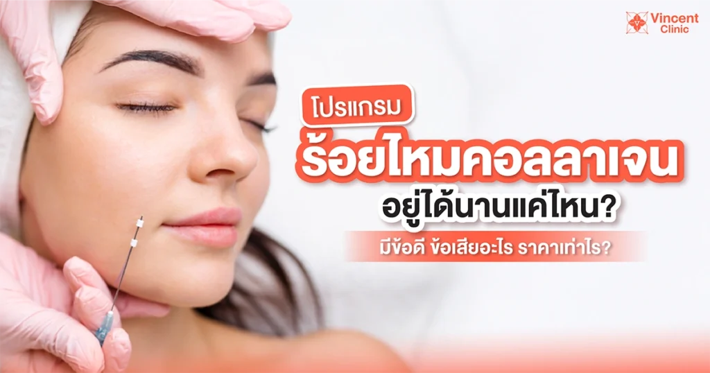 โปรแกรมร้อยไหมคอลลาเจนอยู่ได้นานแค่ไหน