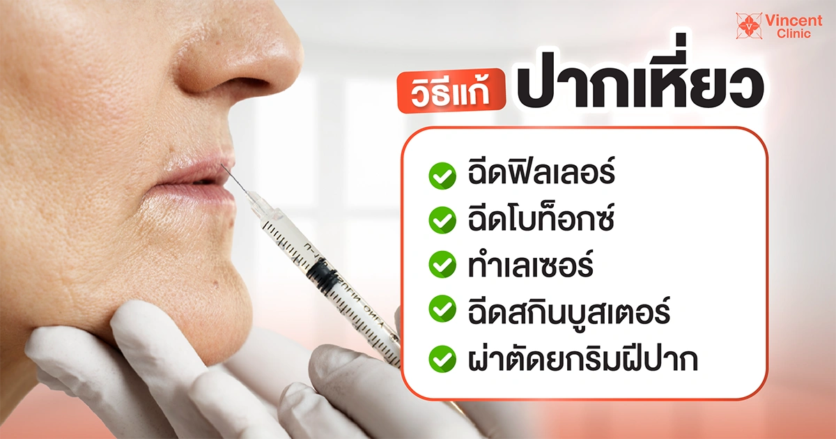 วิธีแก้ปากเหี่ยว