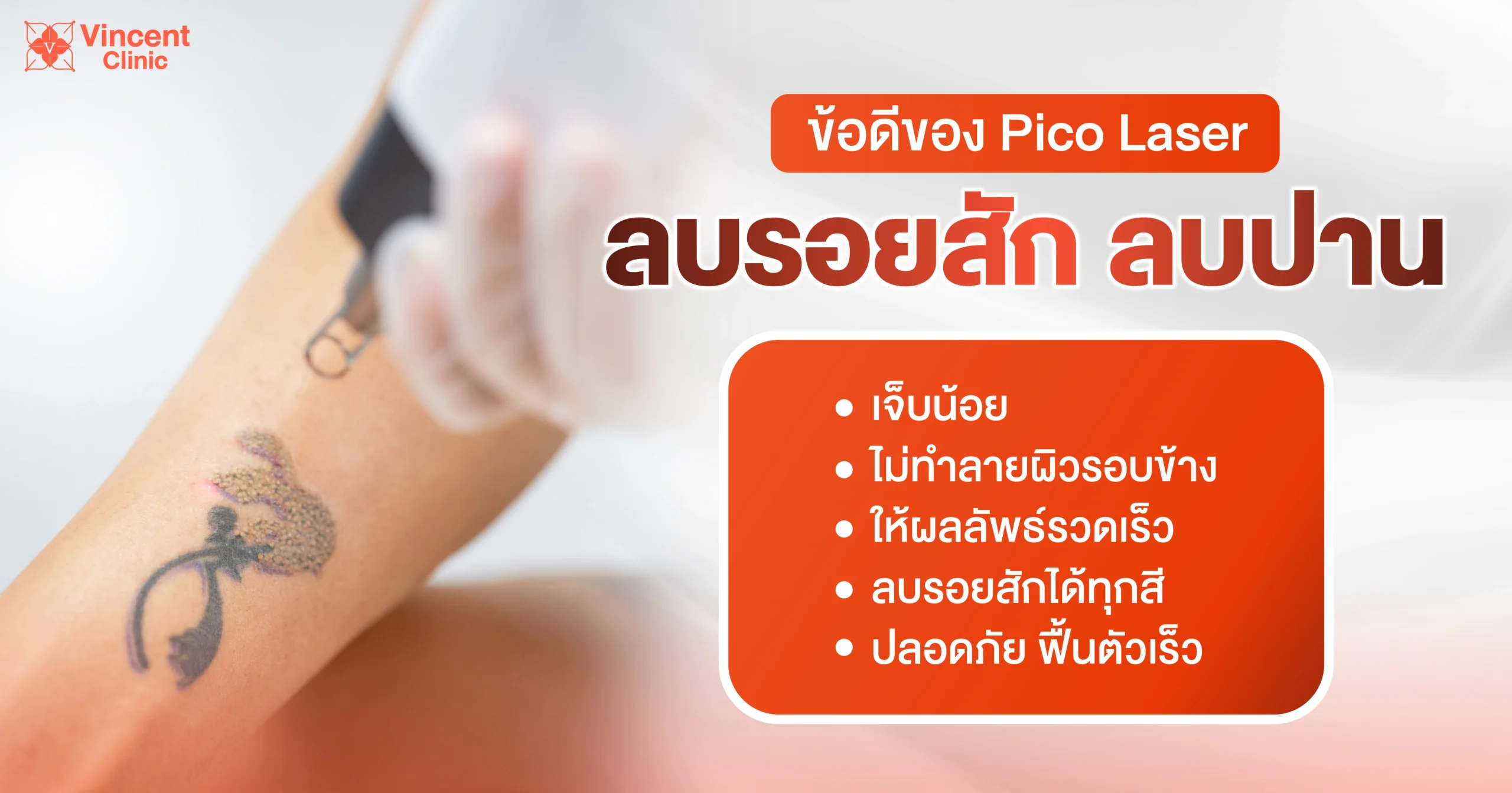 ข้อดีของลบรอยสัก ลบรอยปานด้วย Pico Laser