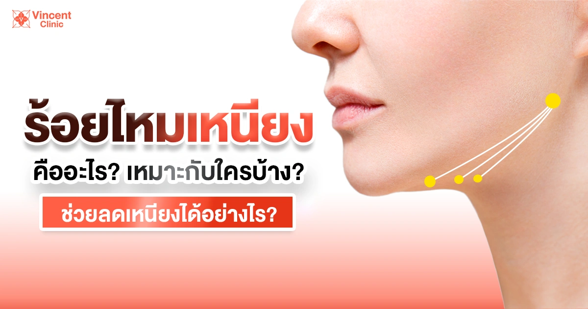 ร้อยไหมเหนียง คืออะไร เหมาะกับใครบ้าง ช่วยลดเหนียงได้อย่างไร?