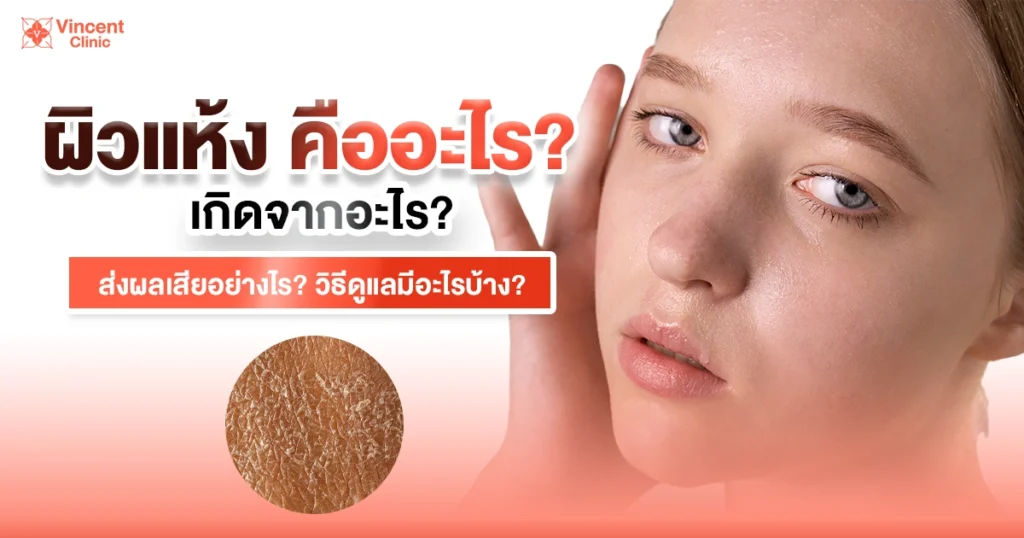 What is dry skin?