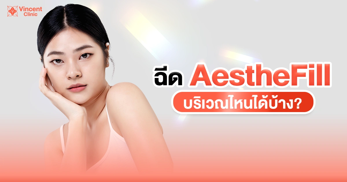aesthefill ฉีดบริเวณไหน