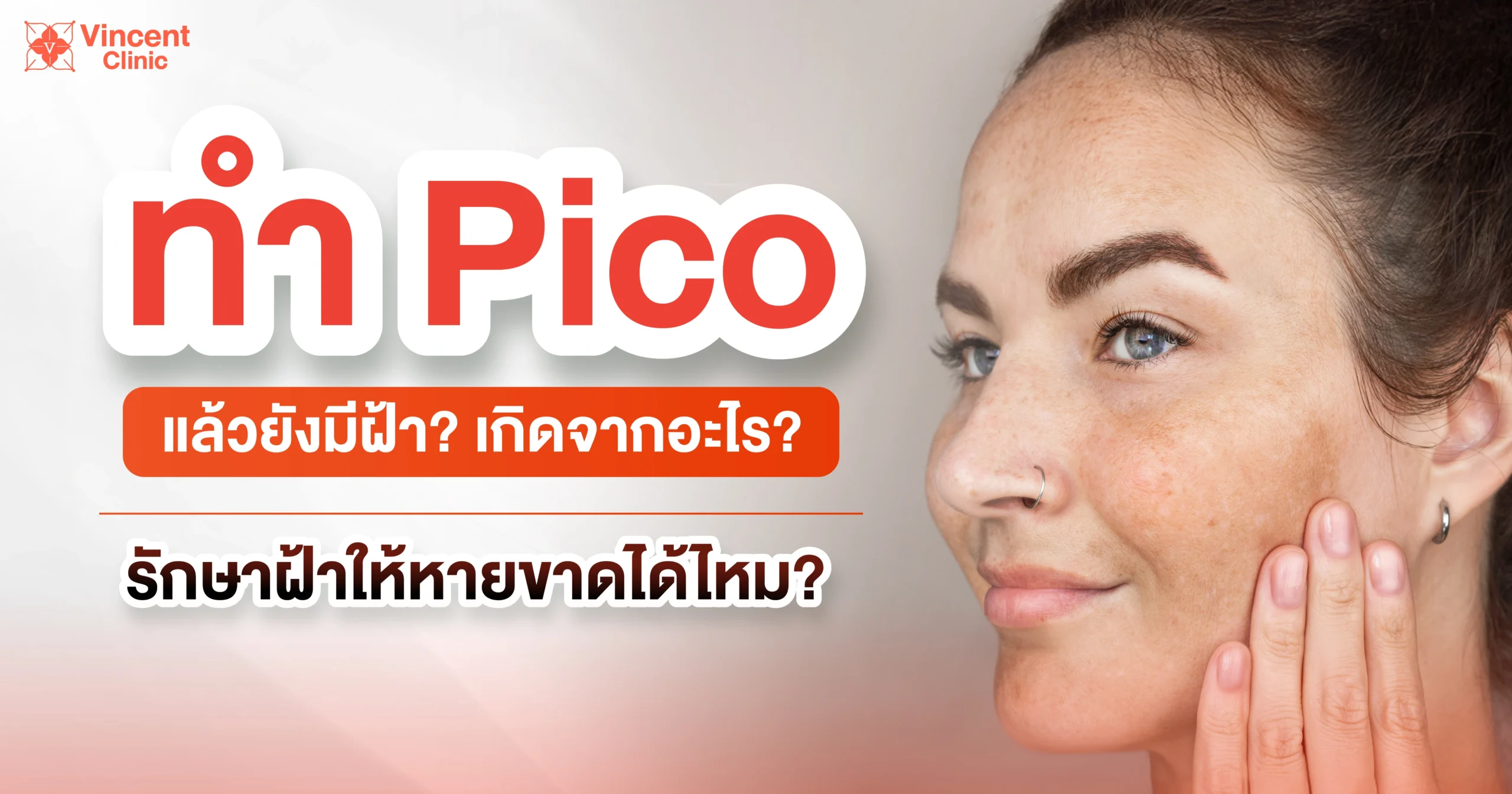 ทำ pico แล้วยังเป็นฝ้าเกิดจากอะไร