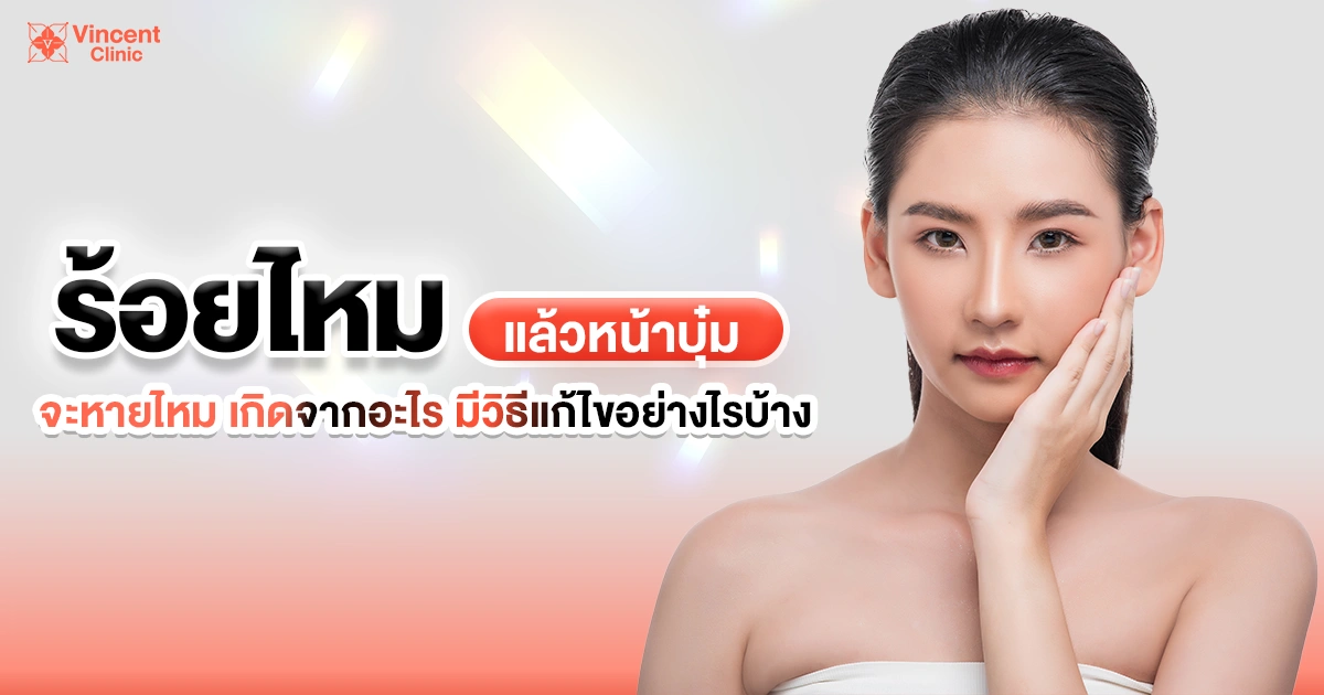 ร้อยไหมแล้วหน้าบุ๋มจะหายไหม