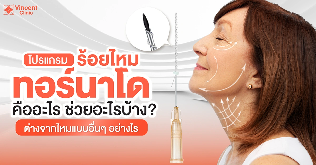 ร้อยไหมทอร์นาโดคืออะไร