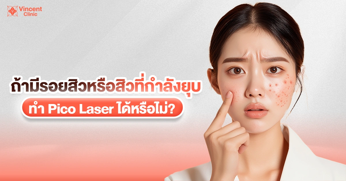 มีรอยสิวหรือสิวกำลังยุบทำ pico laser ได้ไหม 