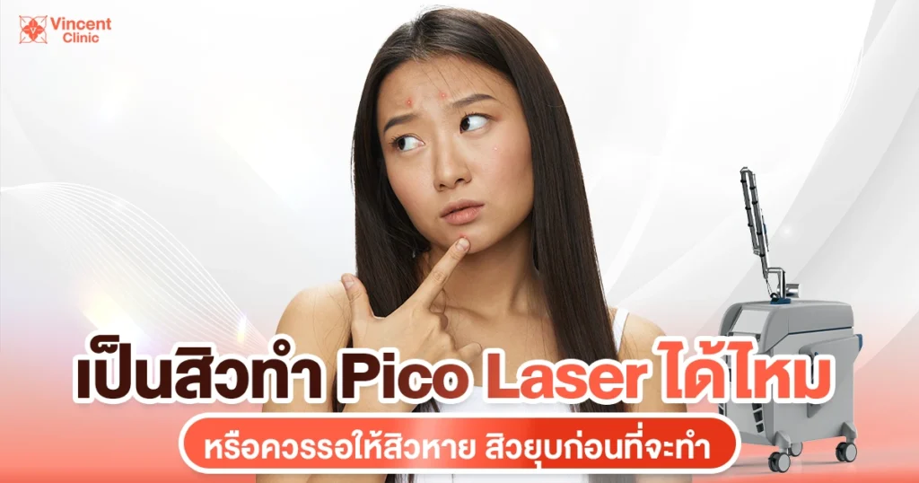 เป็นสิวทำ pico laser ได้ไหม