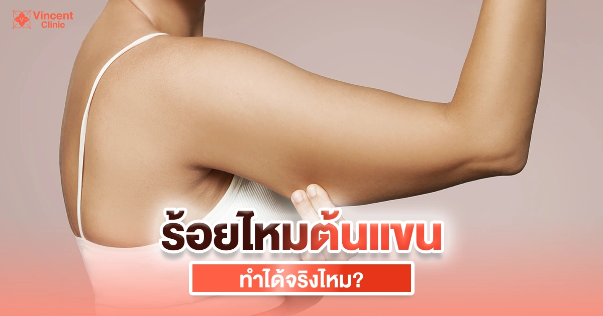 ร้อยไหมต้นแขนทำได้จริงไหม