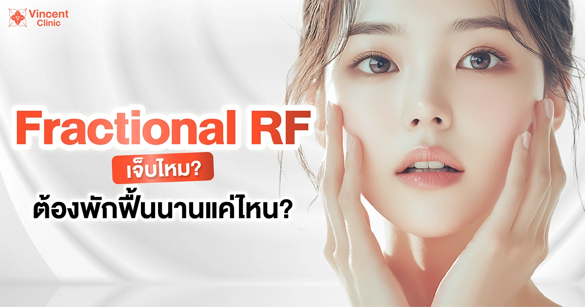 fractional rf เจ็บไหม