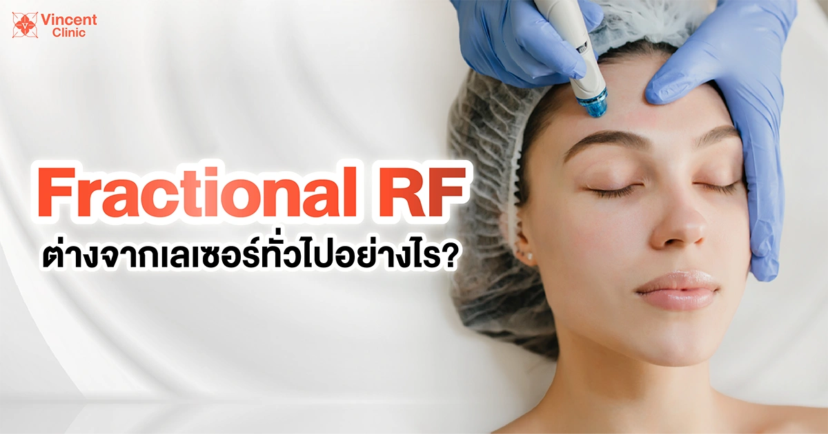 fractional rf ต่างจากเลเซอร์ทั่วไปอย่างไร