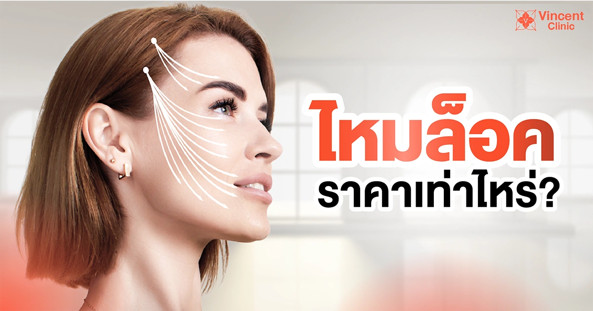 ไหมล็อคราคาเท่าไร