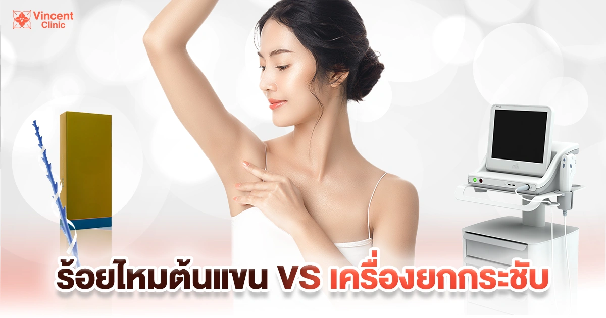 ร้อยไหมต้นแขน vs เครื่องยกกระชับ