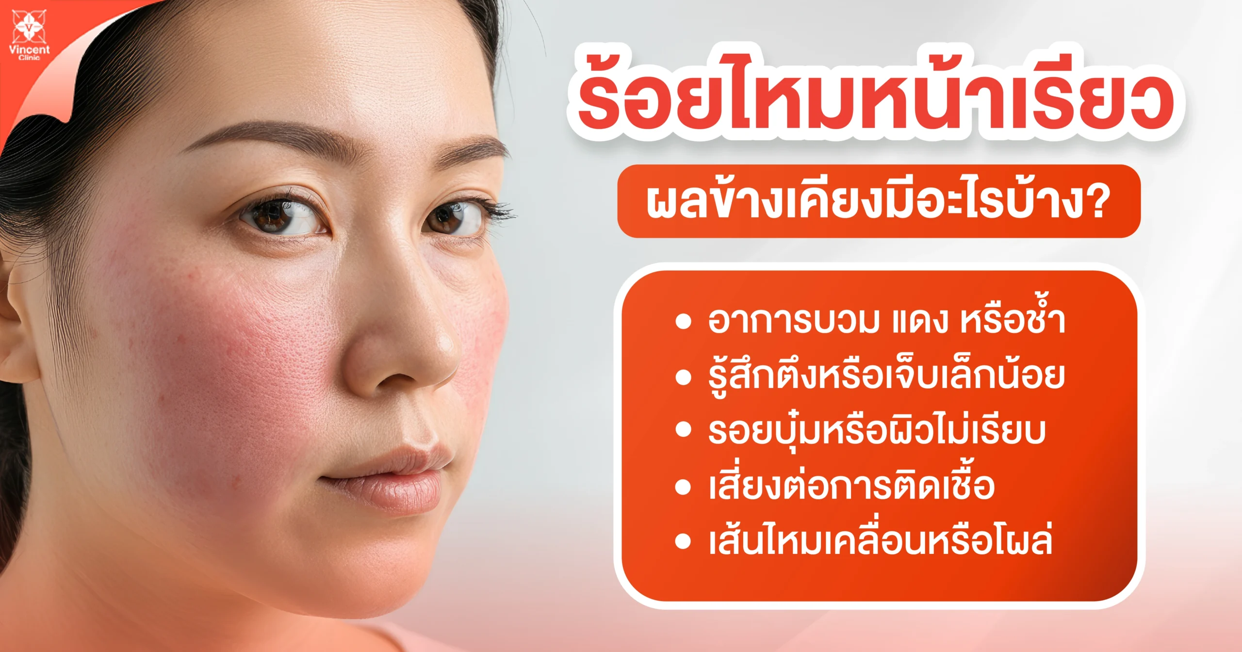 What are the side effects of a face-slimming thread lift? ร้อยไหมหน้าเรียว ผลข้างเคียงมีอะไรบ้าง
