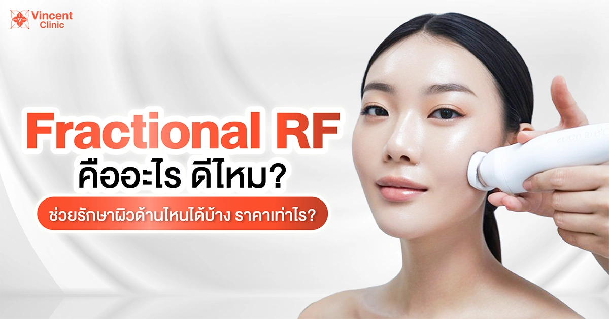 fractional rf คืออะไร