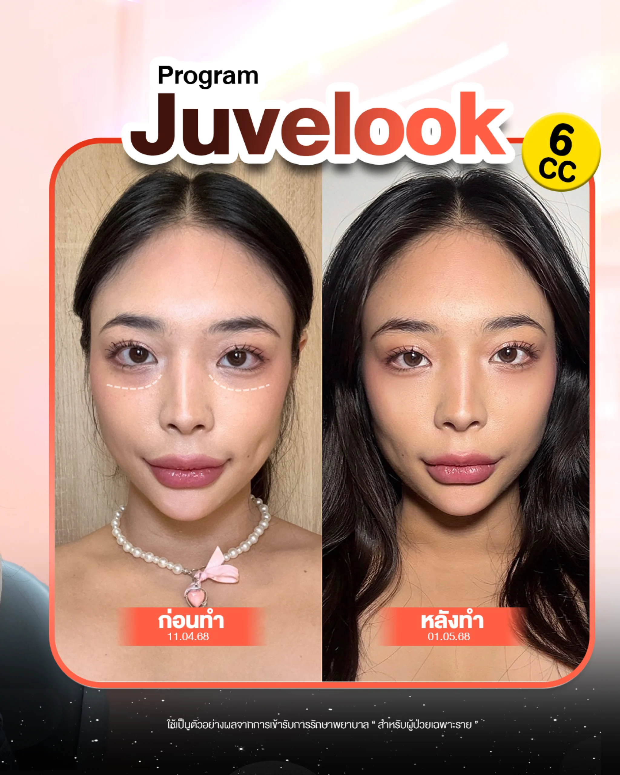 review juvelook