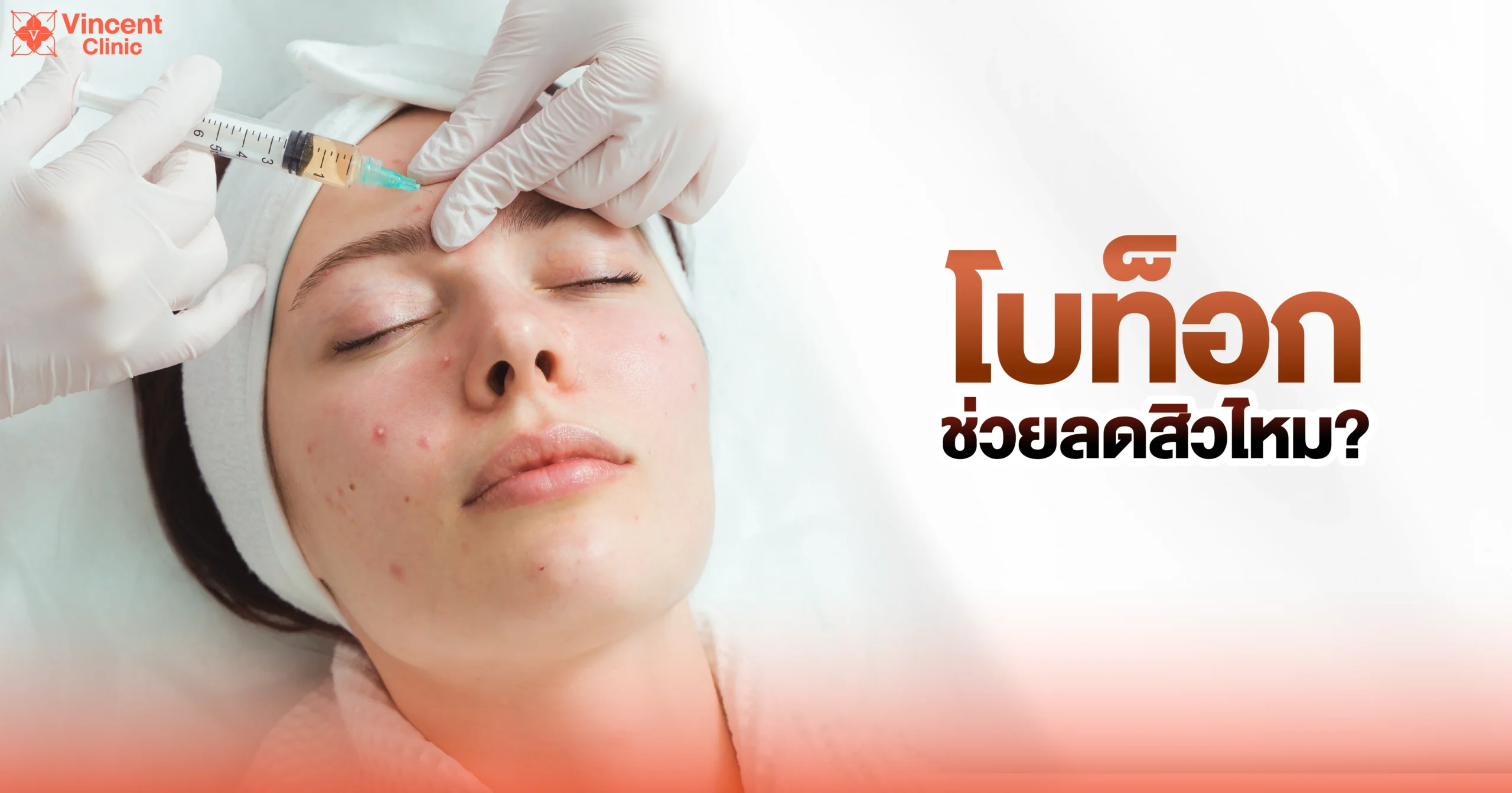 โบท็อกช่วยลดสิวไหม