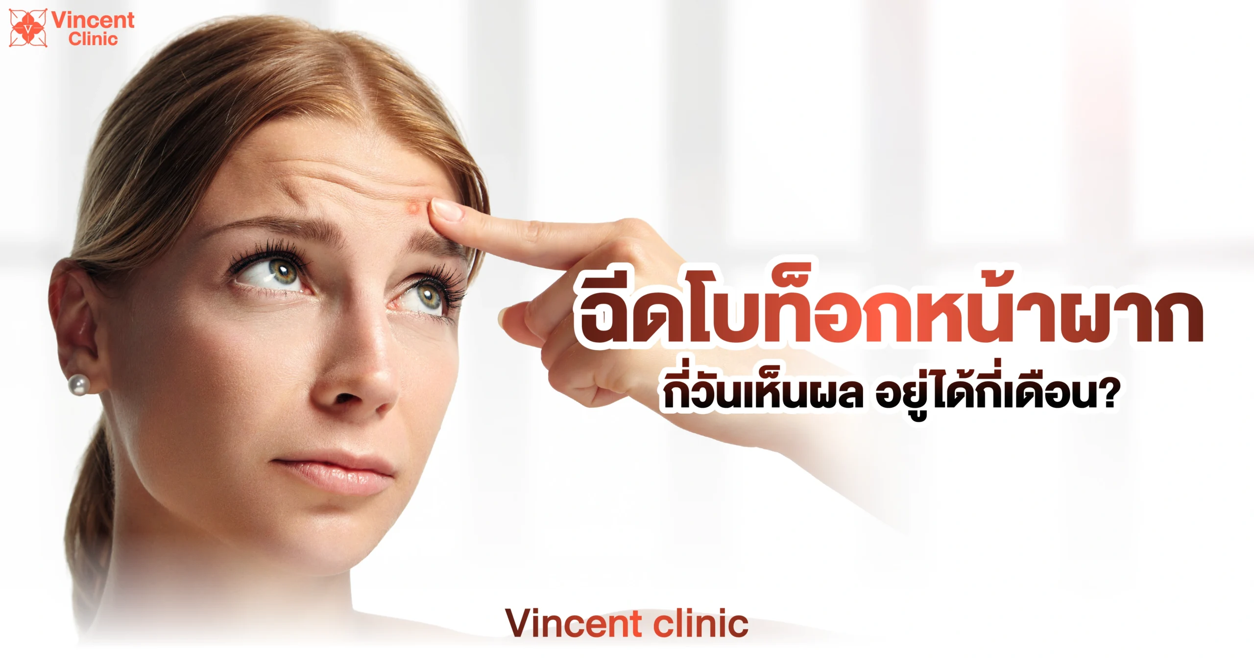 How many days does forehead Botox take to show results?