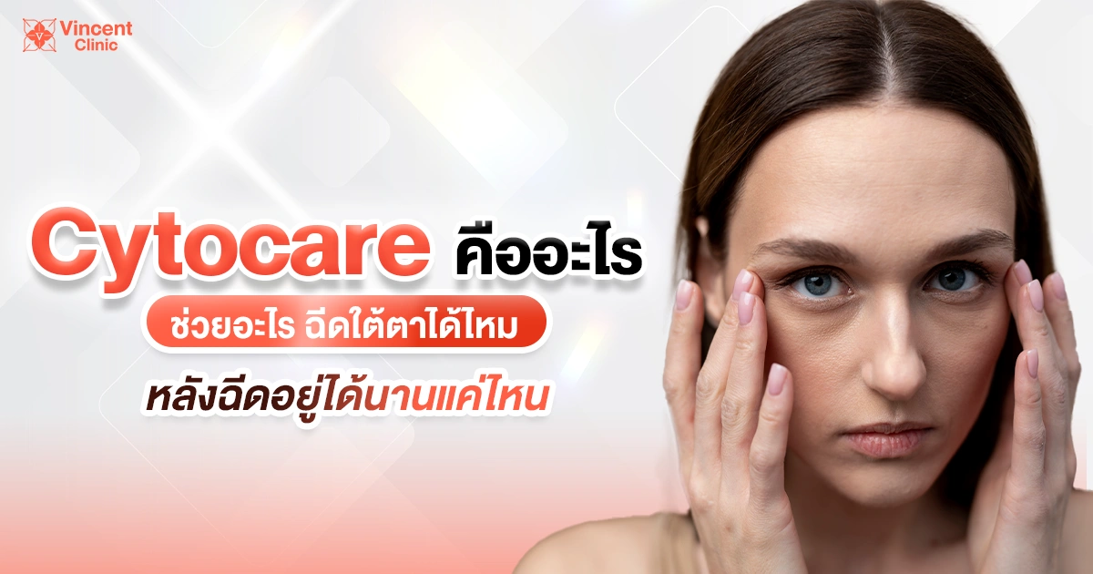 cytocare คืออะไร