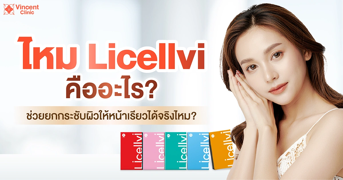 ไหม licellvi คืออะไร