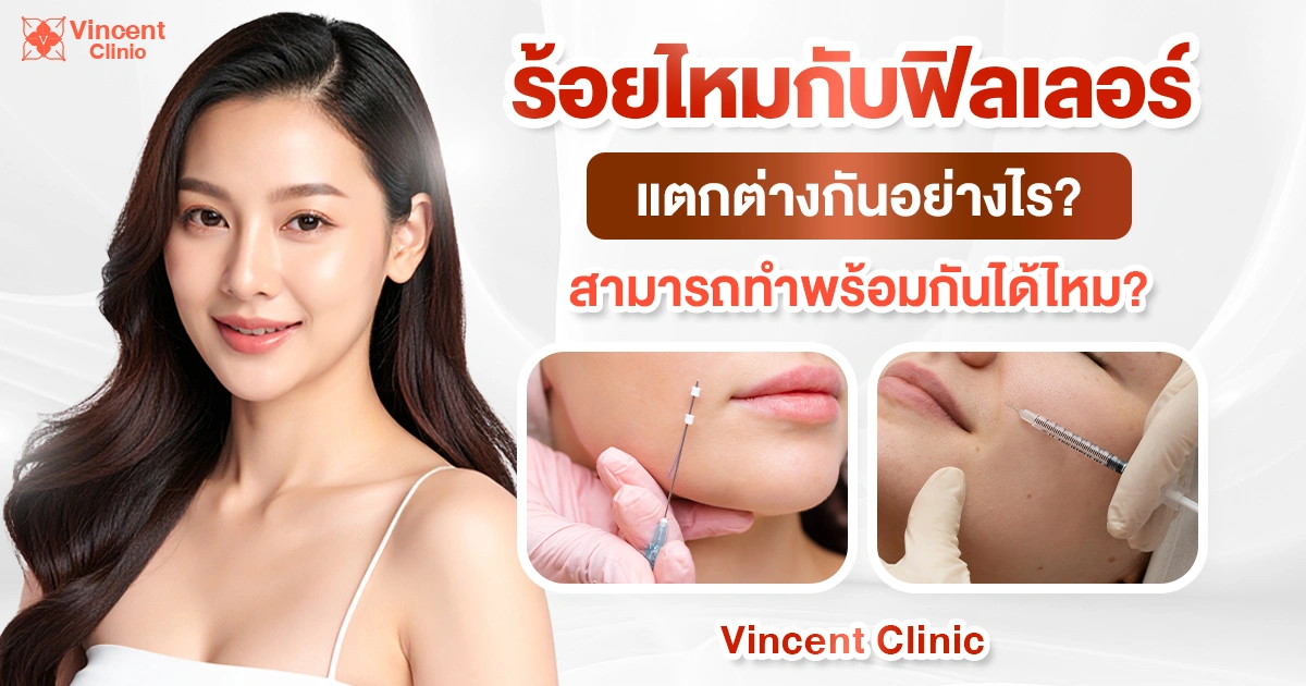 How are thread lifting and fillers different?.psd ร้อยไหมกับฟิลเลอร์แตกต่างกันอย่างไร