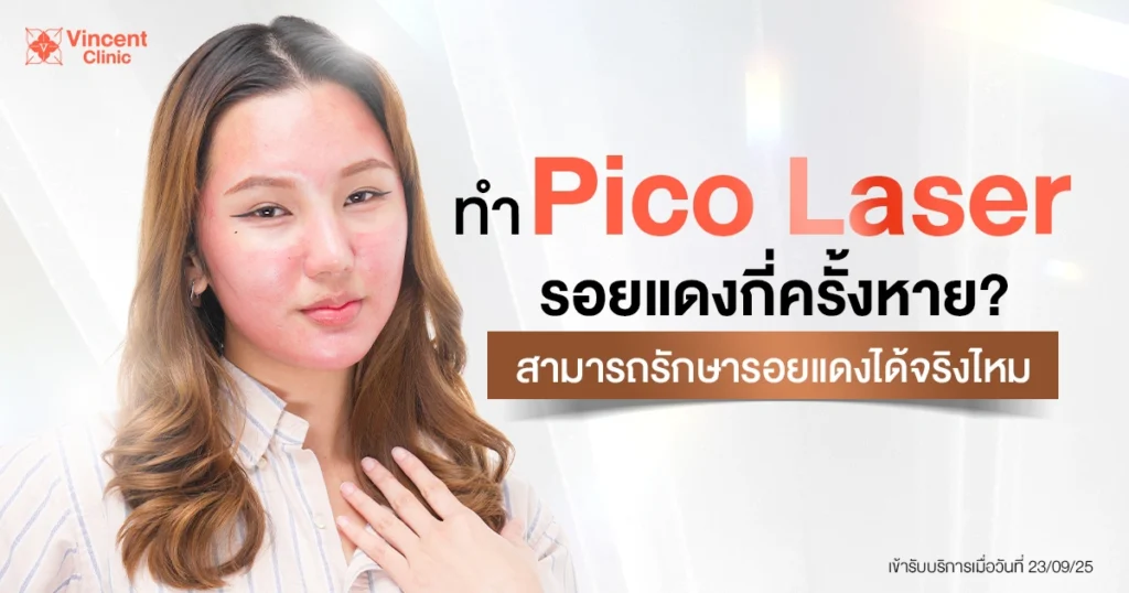 How many Pico Laser sessions are needed for redness to fade?