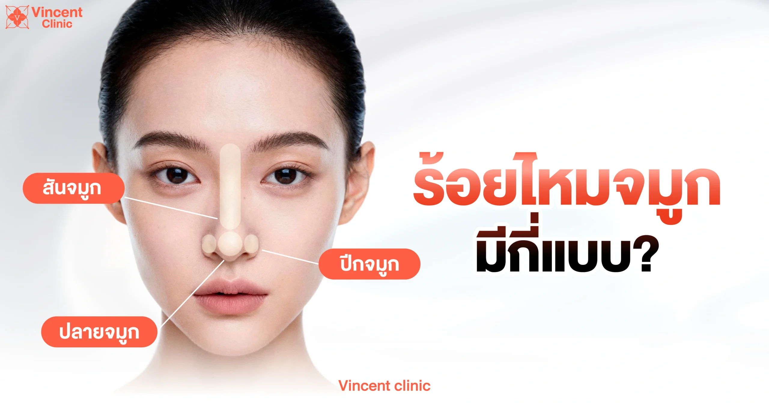 How many types of nose thread lifting are there? ร้อยไหมจมูกมีกี่แบบ