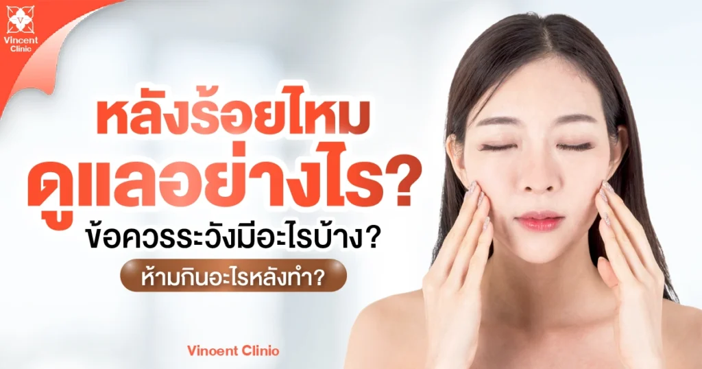 หลังร้อยไหมดูแลอย่างไร