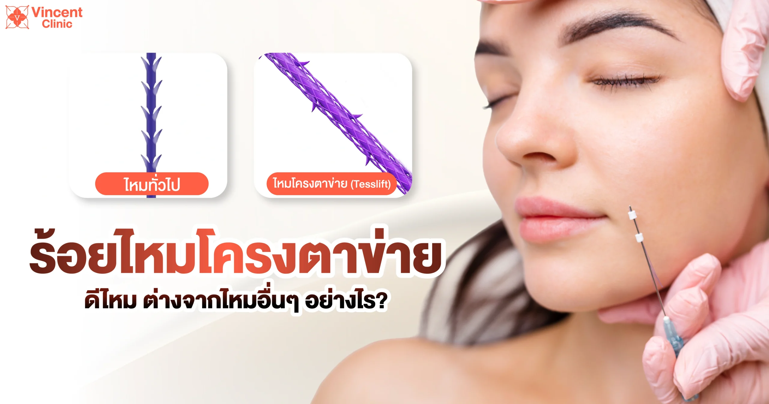 Is Tesslift thread lifting good? ร้อยไหมโครงตาข่ายดีไหม