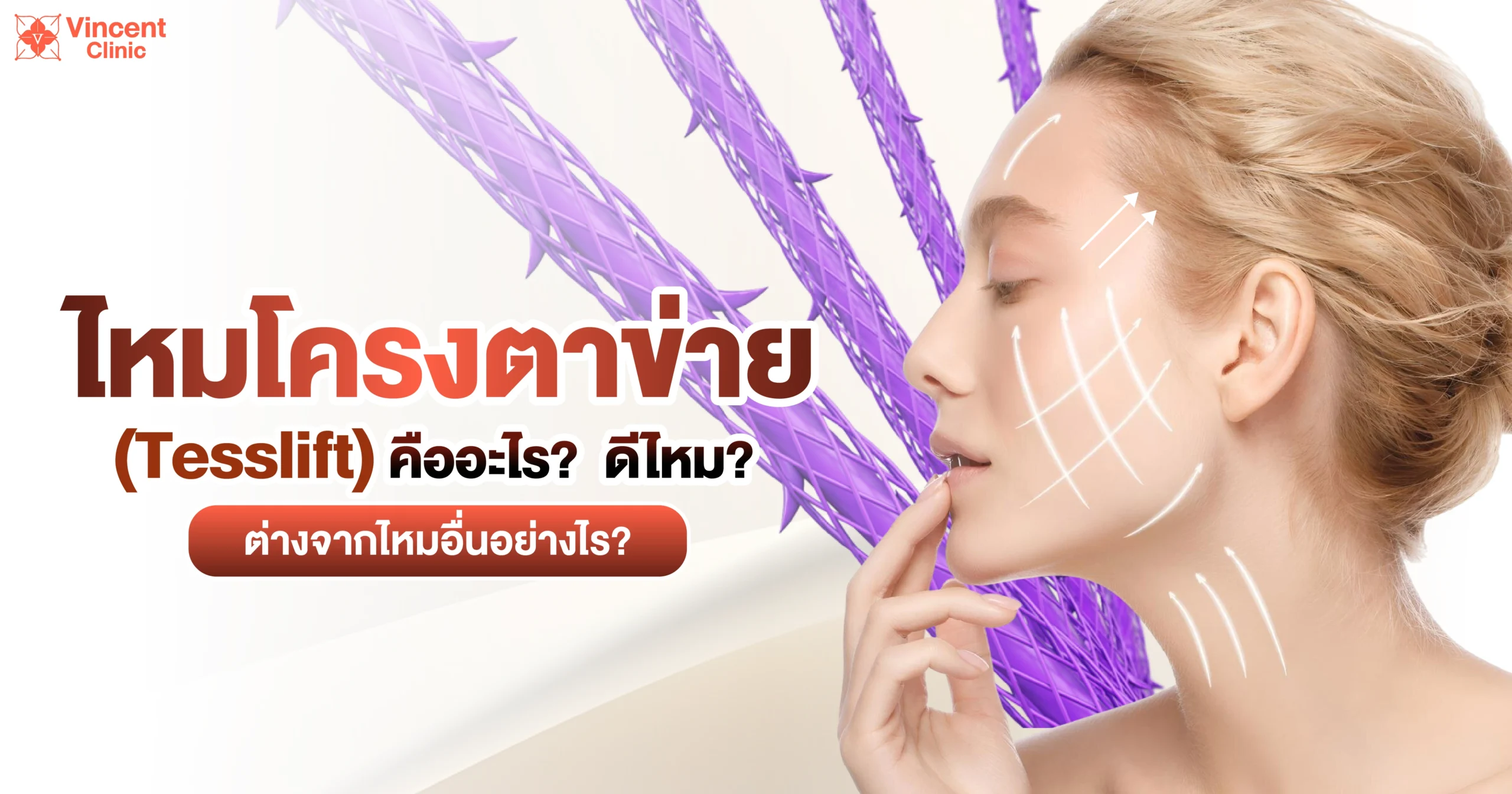 ไหมโครงตาข่ายคืออะไร