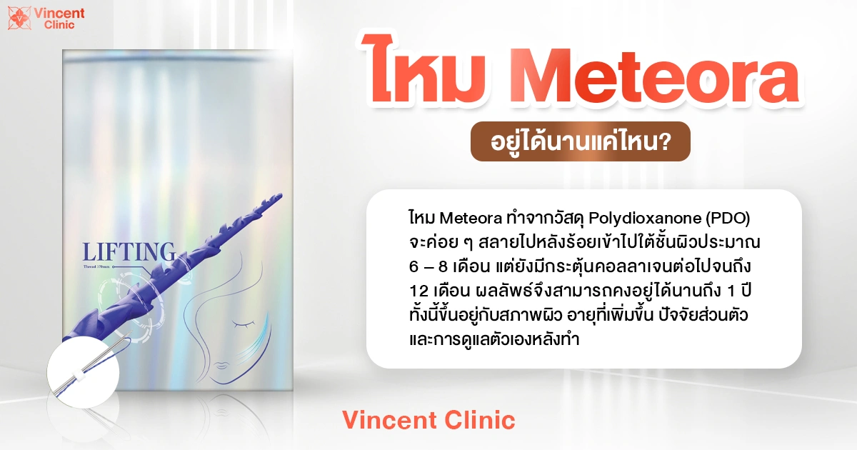 How long does Meteora thread last? ไหม meteora อยู่ได้นานแค่ไหน