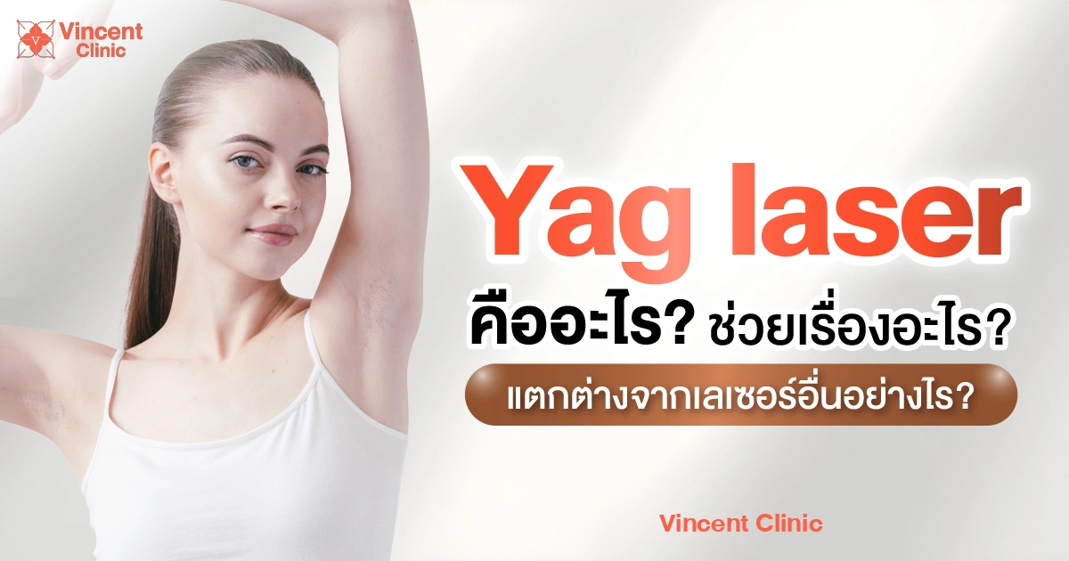 Yag laser คืออะไร ช่วยเรื่องอะไร แตกต่างจากเลเซอร์อื่นอย่างไร?