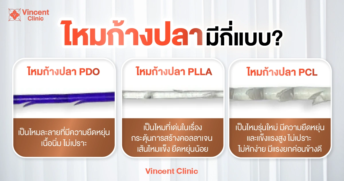 ไหมก้างปลา มีกี่แบบ