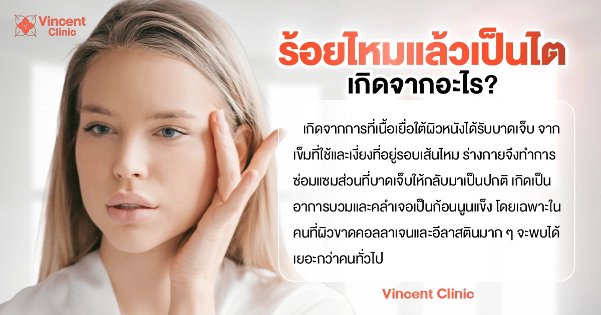 The thread is pulled too tight ร้อยไหมแล้วเป็นไต เกิดจากอะไร?