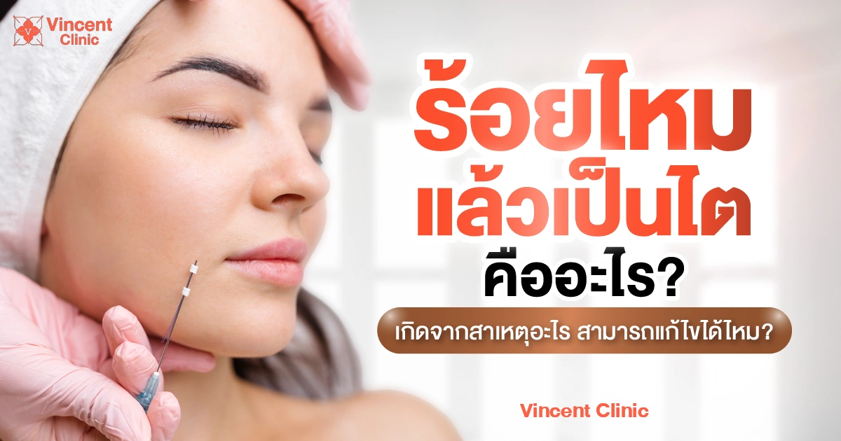 ร้อยไหมแล้วเป็นไต คืออะไร เกิดจากสาเหตุอะไร สามารถแก้ไขได้ไหม?