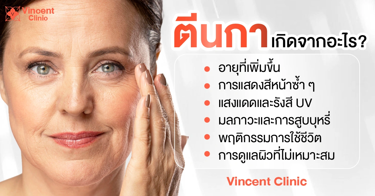 What causes crow’s feet? ตีนกาเกิดจากอะไร