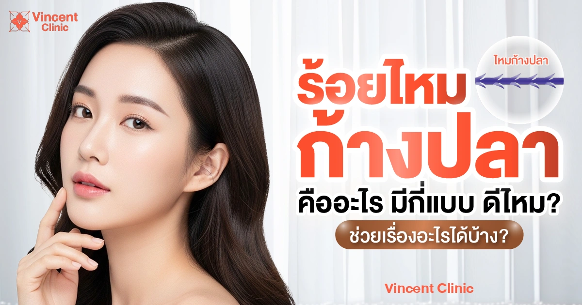 ร้อยไหมก้างปลา คืออะไร มีกี่แบบ ดีไหม ช่วยเรื่องอะไรได้บ้าง