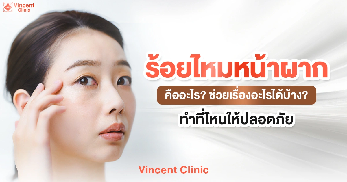 ร้อยไหมหน้าผาก