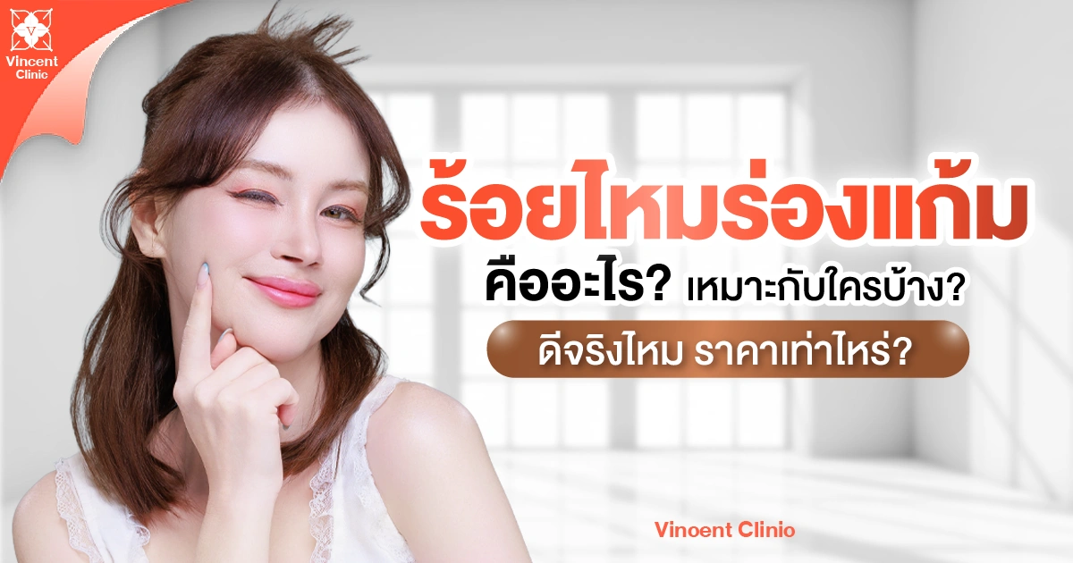 ร้อยไหมร่องแก้มคืออะไร