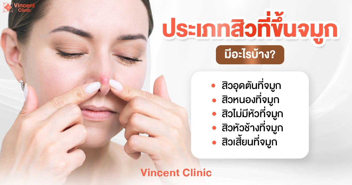 What types of acne can occur on the nose? ประเภทสิวที่ขึ้นจมูก มีอะไรบ้าง