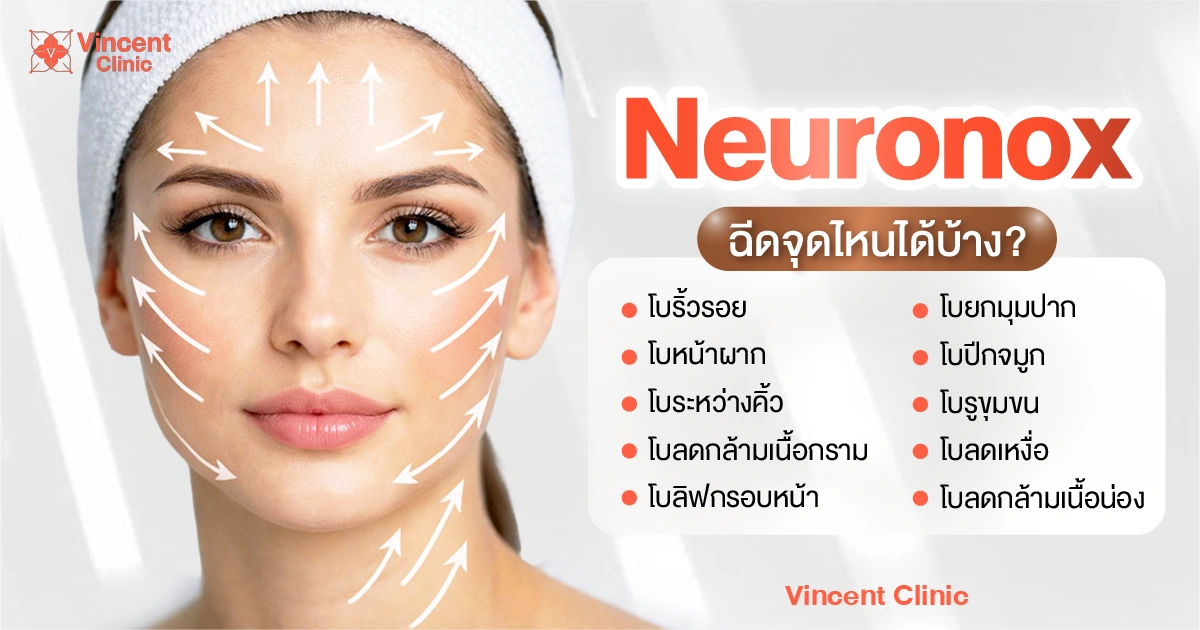 โบ Neuronox ฉีดจุดไหนได้บ้าง?