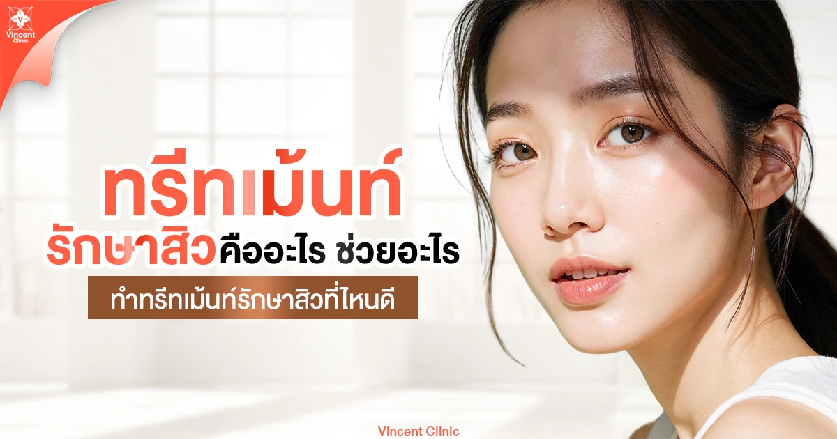 ทรีทเม้นท์รักษาสิว