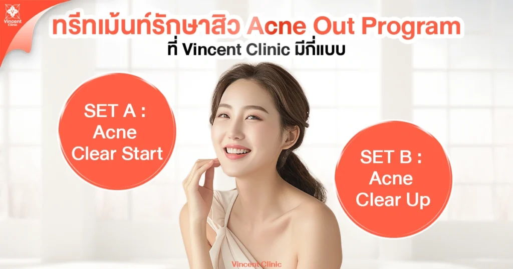 ทรีทเม้นท์รักษาสิวมีกี่แบบ