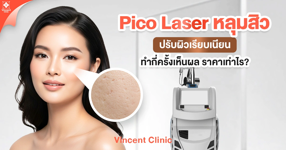 Pico Laser หลุมสิว ปรับผิวเรียบเนียน ทำกี่ครั้งเห็นผล ราคาเท่าไร?