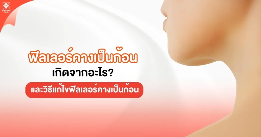 ฟิลเลอร์คางเป็นก้อน