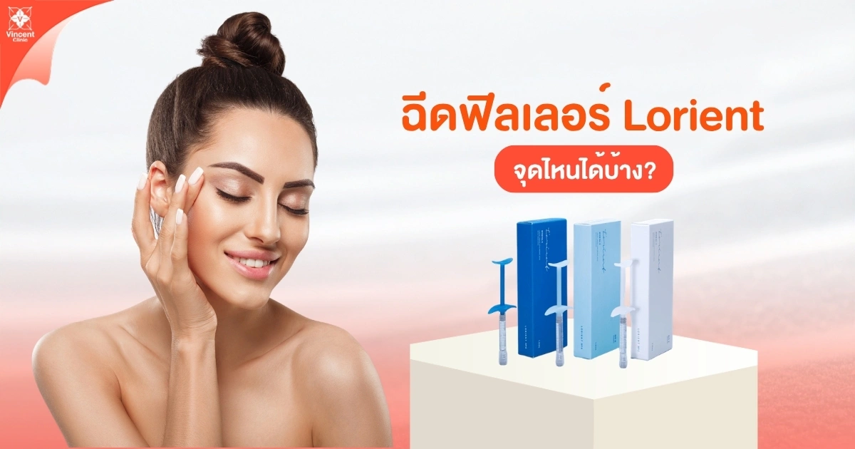 ฉีดฟิลเลอร์ Lorient จุดไหนได้บ้าง