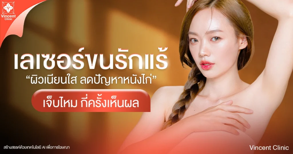 เลเซอร์ขนรักแร้ กำจัดขนรักแร้ถาวรไหม กี่ครั้งเห็นผล ราคาเท่าไร?